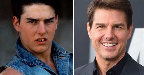 are people in tennessee known for fake teeth